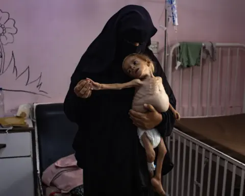 El niño palestino Sham Qudeih en medio de la hambruna que se extiende por Gaza, por EPA.