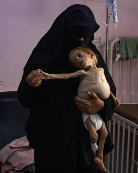 El niño palestino Sham Qudeih en medio de la hambruna que se extiende por Gaza, por EPA.