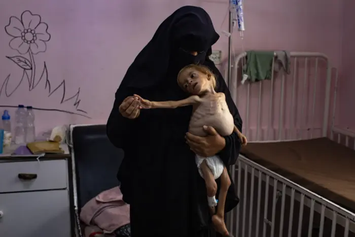 El niño palestino Sham Qudeih en medio de la hambruna que se extiende por Gaza, por EPA.