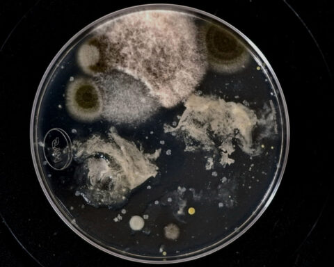 "El oscuro verano en mi jardín está llegando a su fin" (2025). Cultivo bacteriano de la fauna, la flora y el ambiente de un jardín casero, cultivo de microbioma humano. Exposición colectiva HOME-S , Christos Kapalos Museum, Isla de Engina, Grecia, 2026